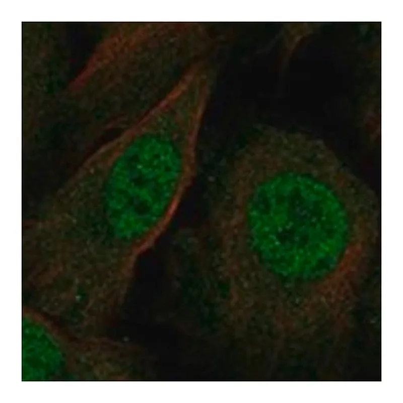 Merck Anti-ZMIZ1 antibody produced in rabbit