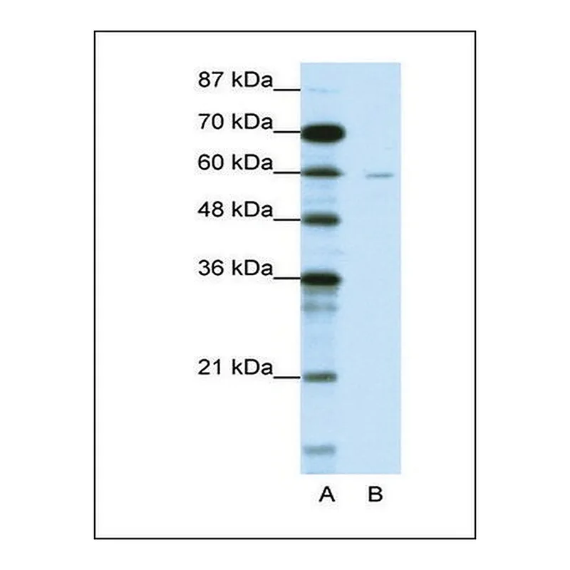 Merck Anti-DCP1A (AB2) antibody produced in rabbit