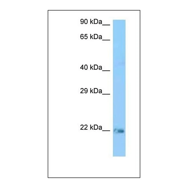 Merck Anti-KRAS antibody produced in rabbit