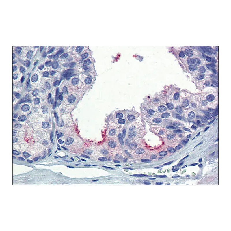 Merck Anti-AMH