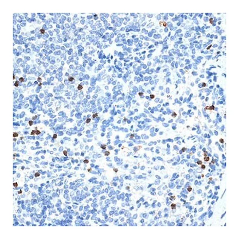Merck ANTI-MMP9 ANTIBODY PRODUCED IN RABBIT
