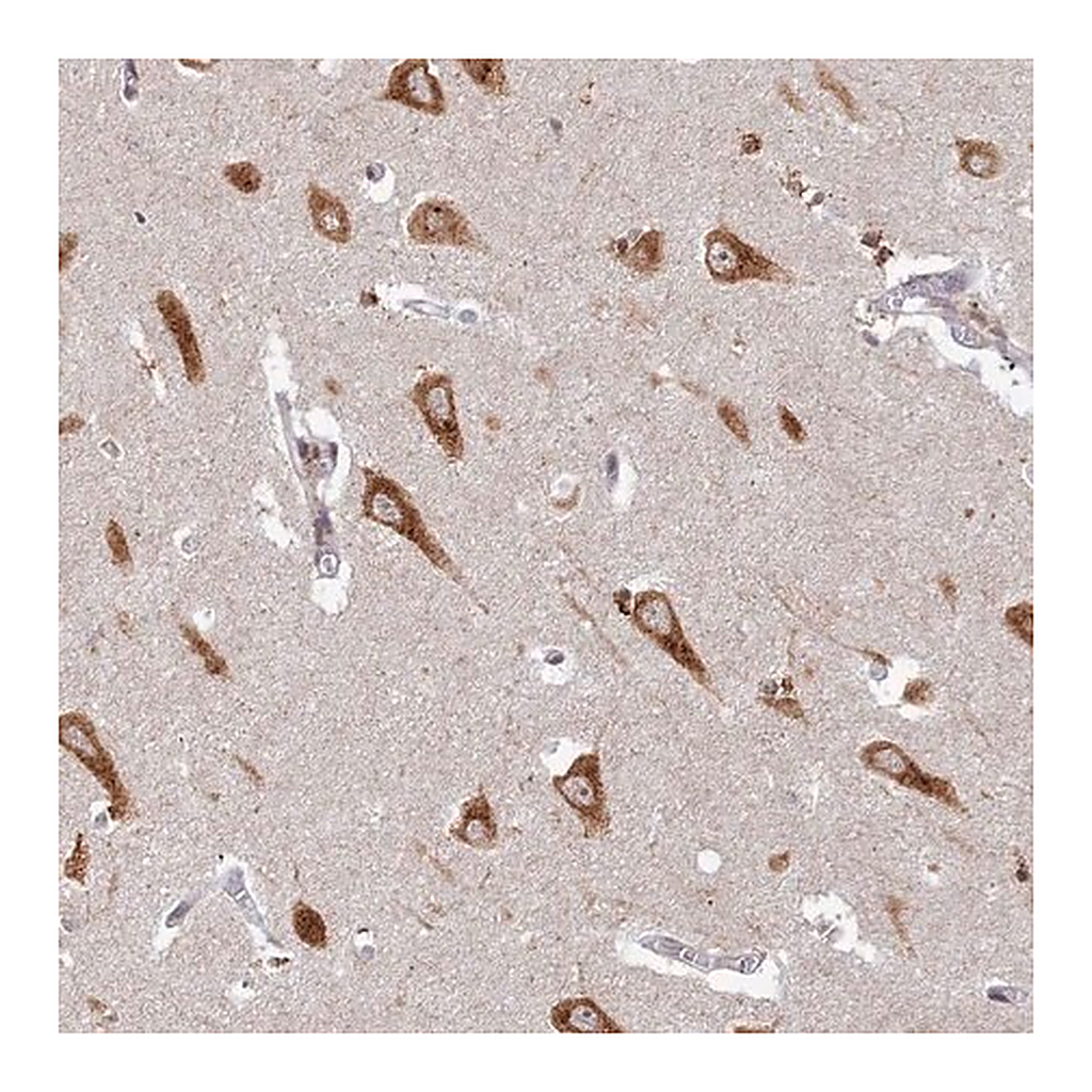 Merck Anti-ABCA2 antibody produced in rabbit