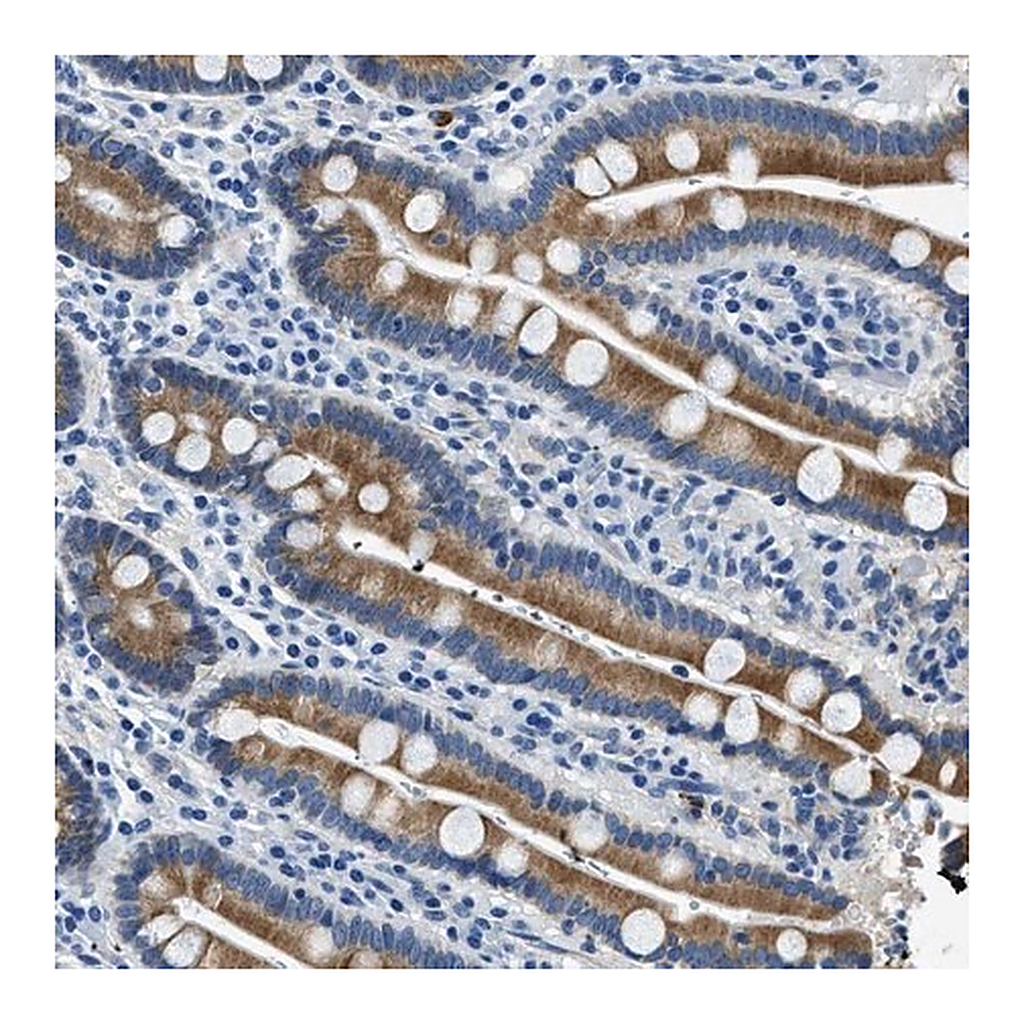 Merck Anti-UBAC2 antibody produced in rabbit