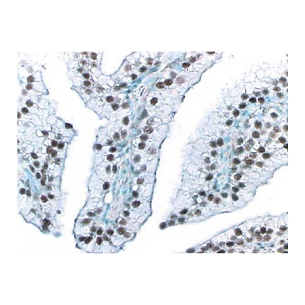 BD Purified Mouse Anti-Human Androgen Receptor