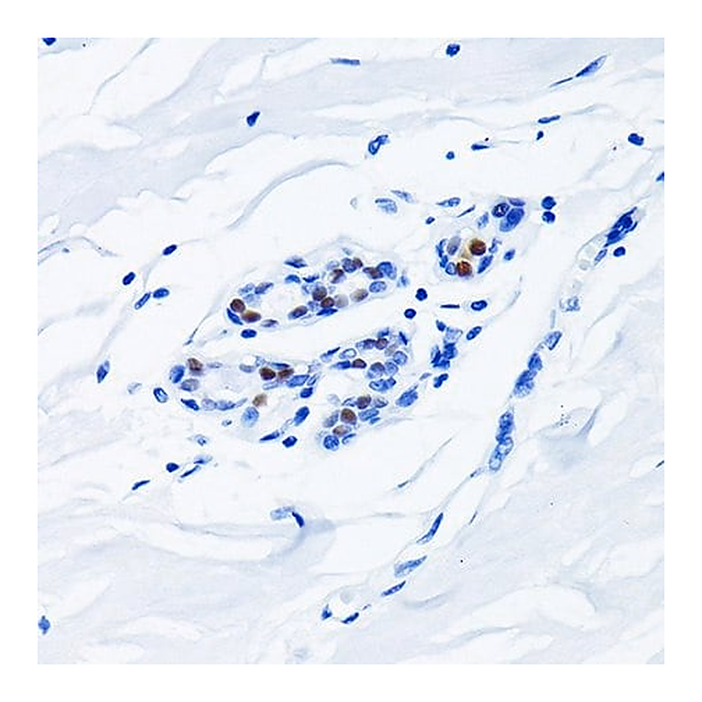 Merck Anti-Androgen Receptor antibody produced in rabbit