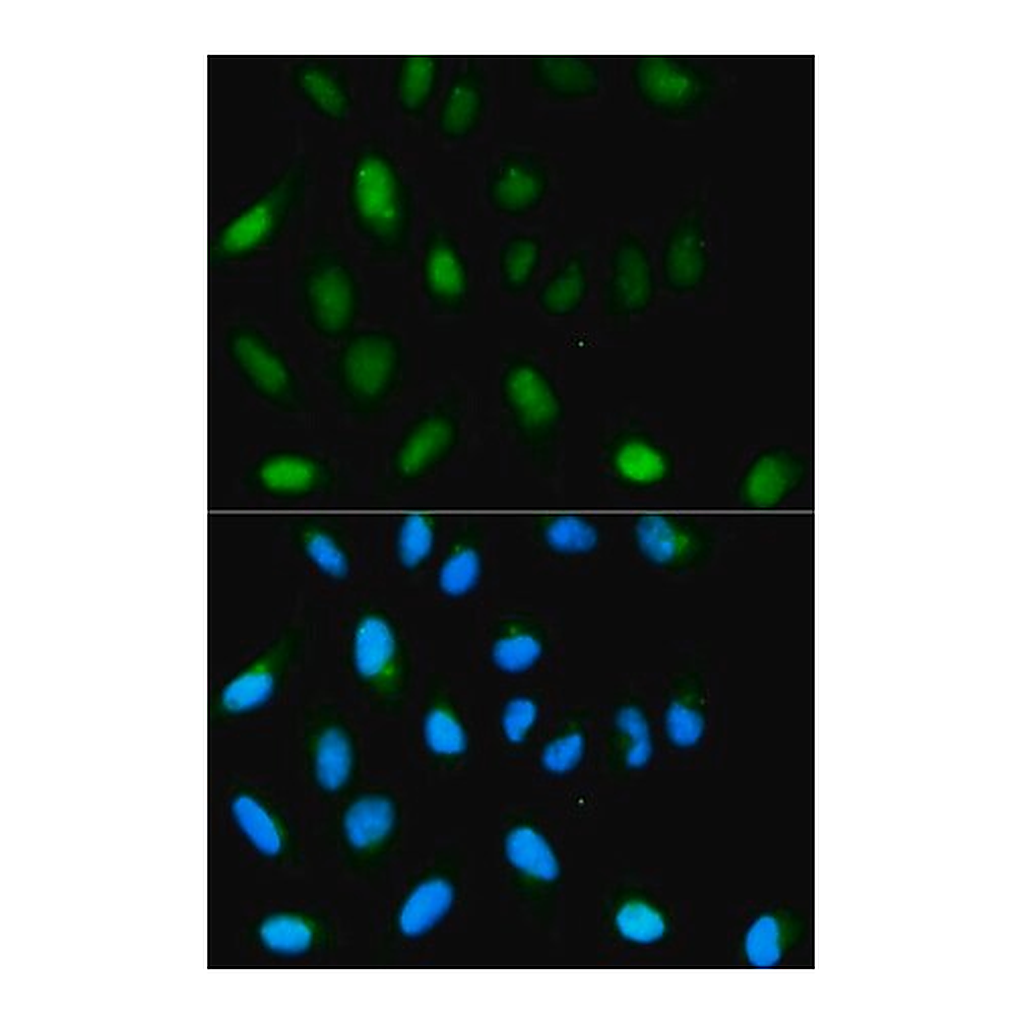 Merck Anti- HP1 alpha/CBX5 antibody produced in rabbit