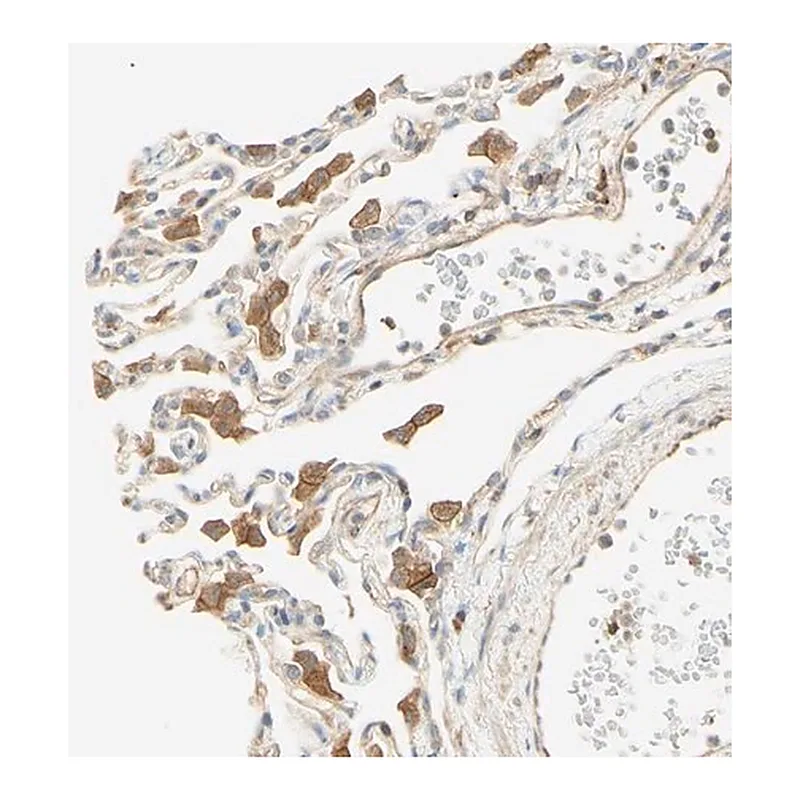 Merck Anti-IKBKG antibody produced in rabbit