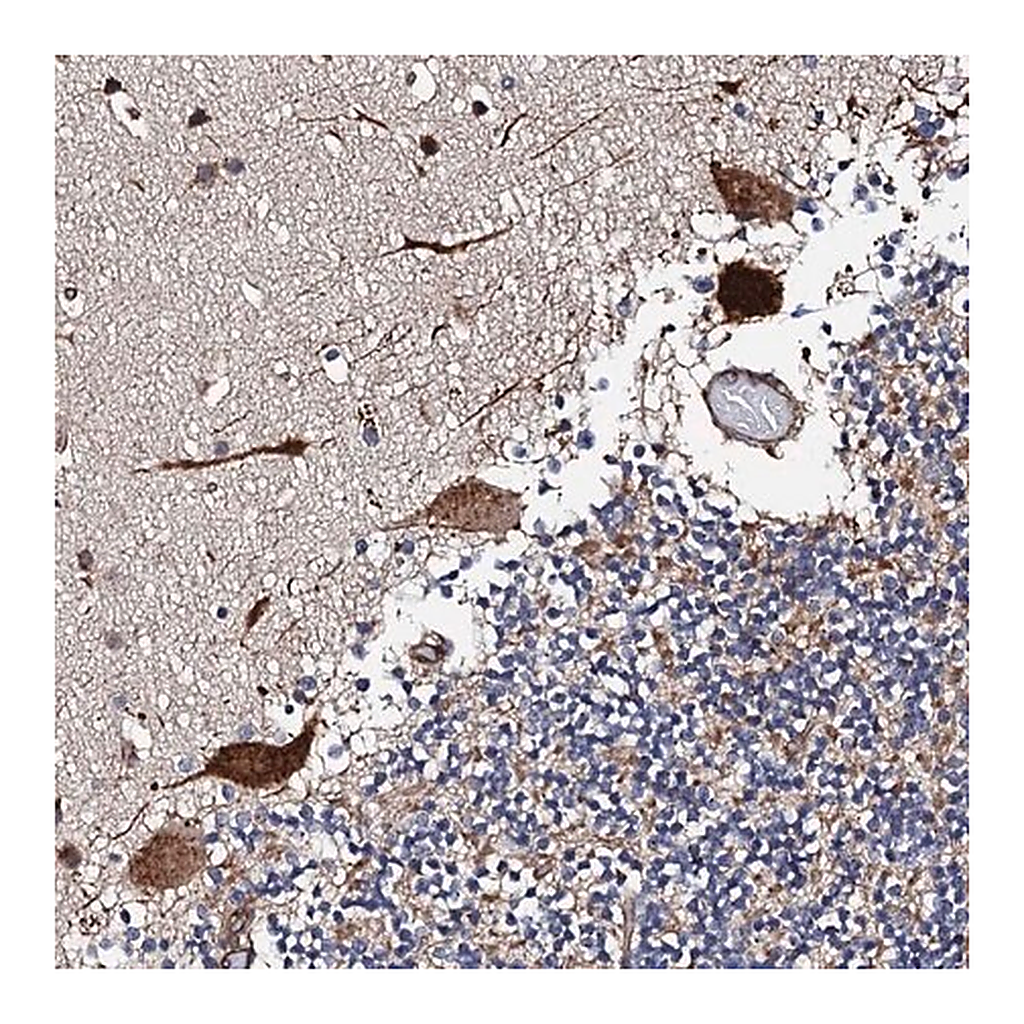 Merck Anti-RCBTB2 antibody produced in rabbit