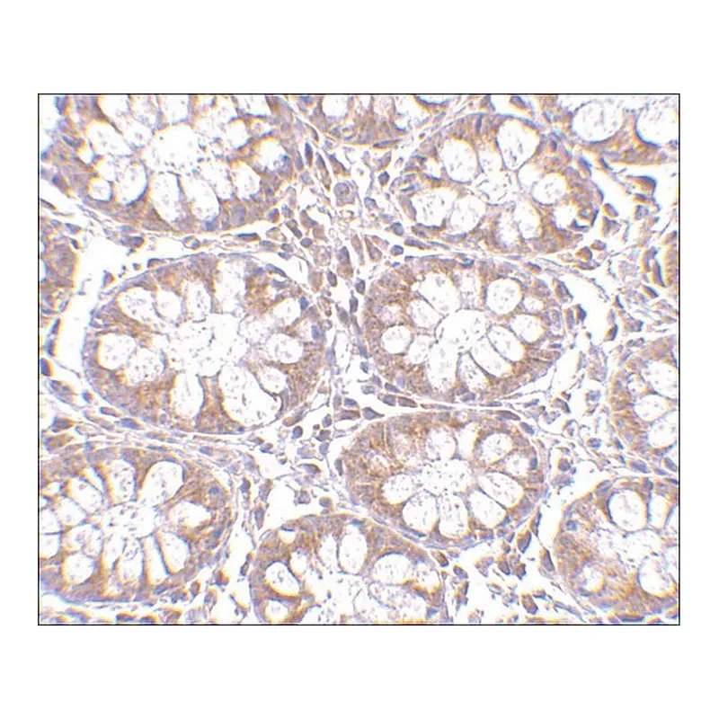Merck Anti-TEM1 (ab1) antibody produced in rabbit