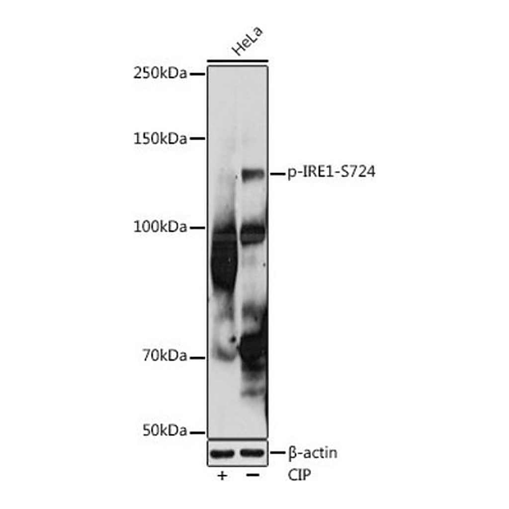 Merck Anti-Phospho-IRE1-S724 antibody produced in rabbit