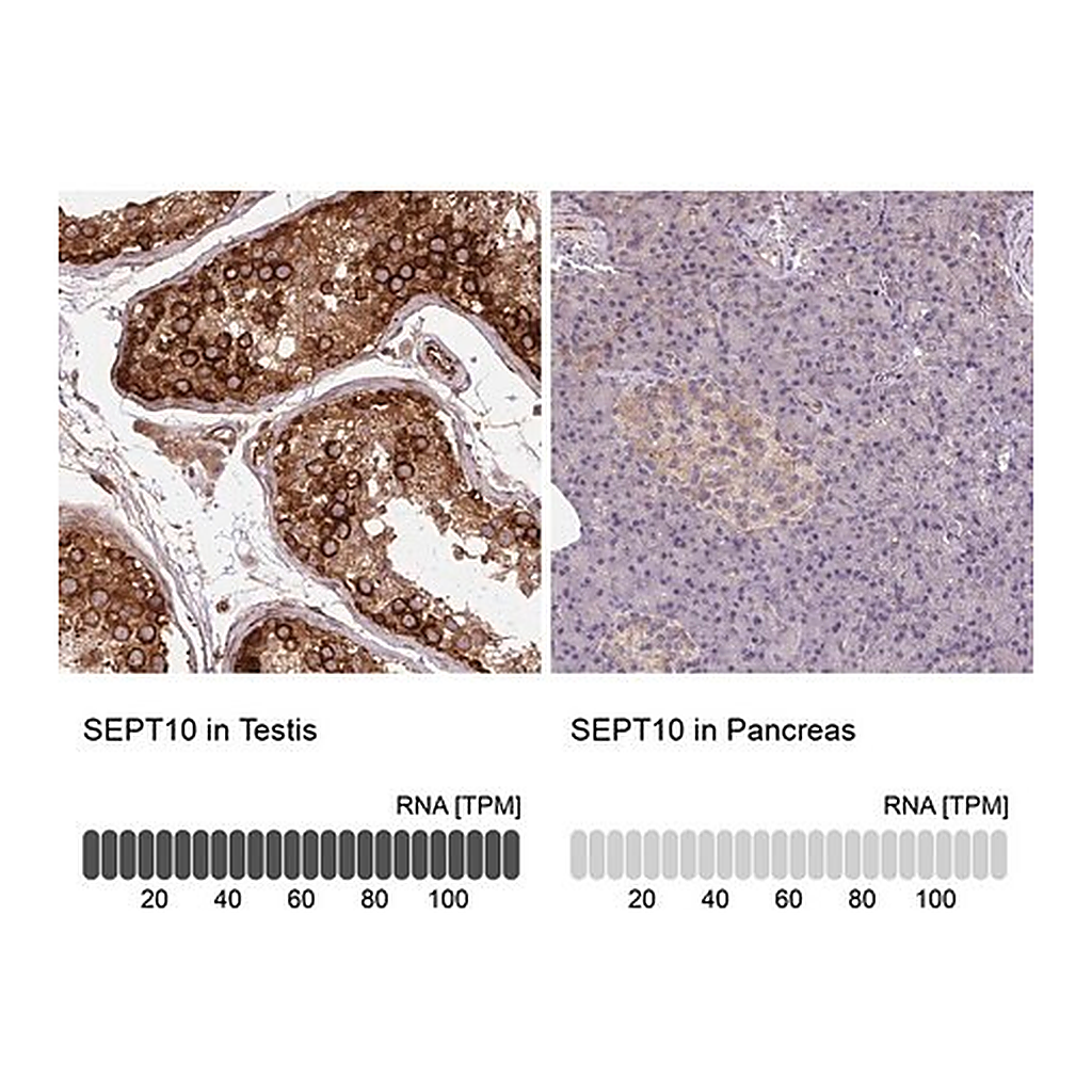 Merck Anti-SEPT10 antibody produced in rabbit