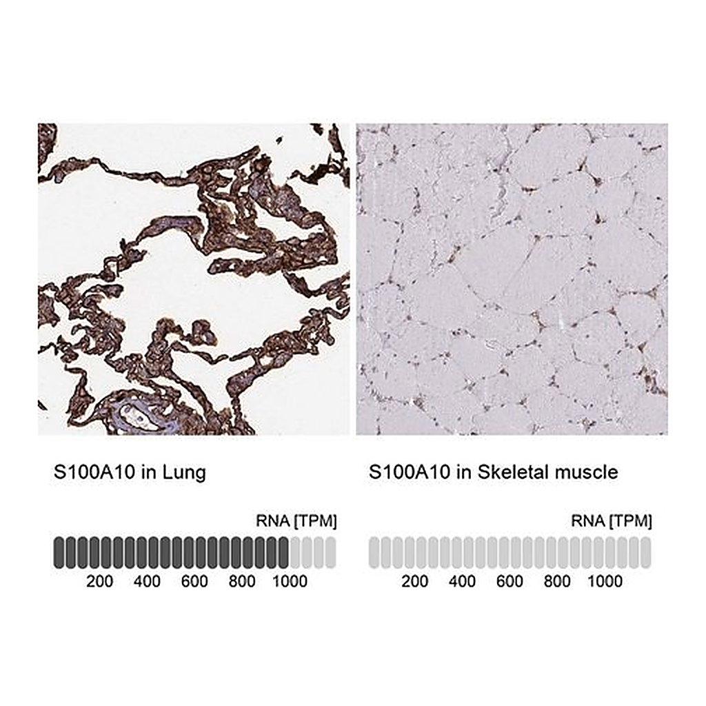 Merck Anti-S100A10 antibody produced in rabbit