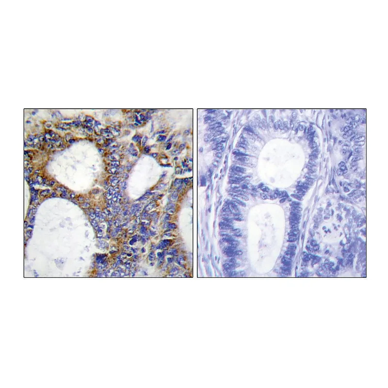 Merck Anti-Collagen I alpha2 antibody produced in rabbit