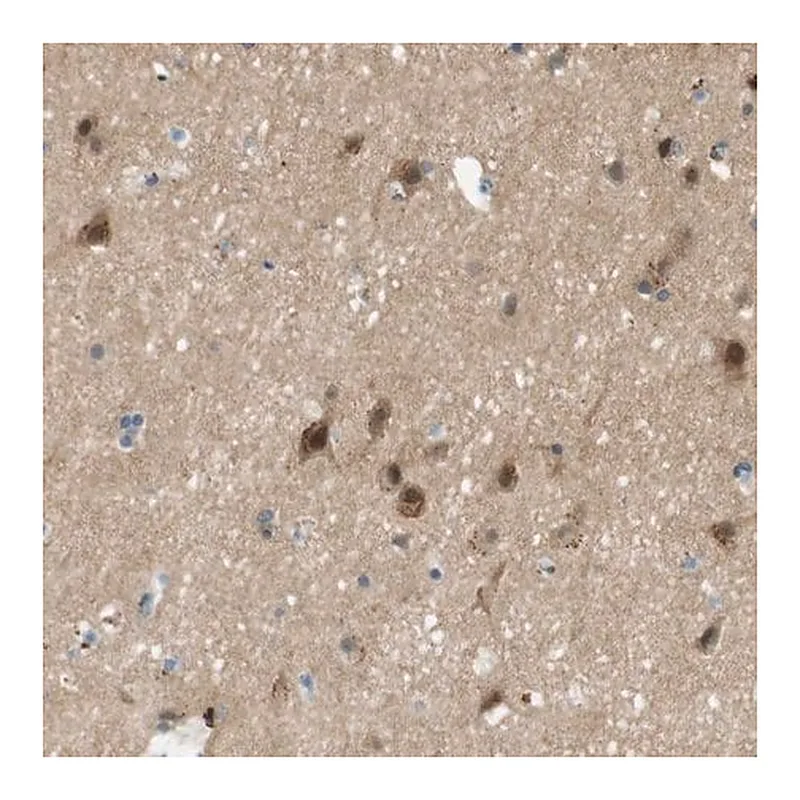 Merck Anti-MAGI2 antibody produced in rabbit