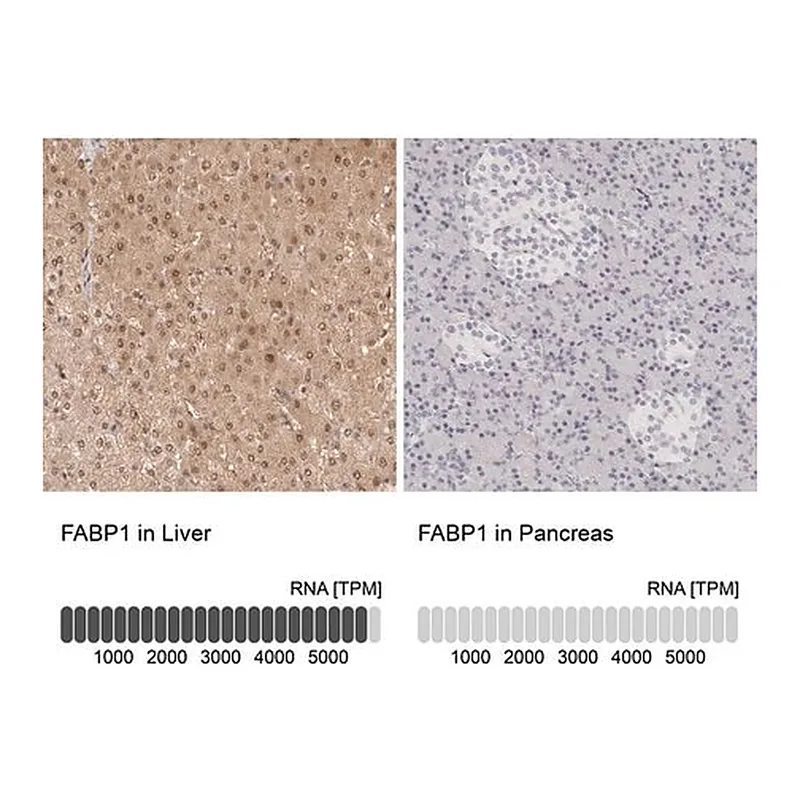 Merck Anti-FABP1 antibody produced in rabbit