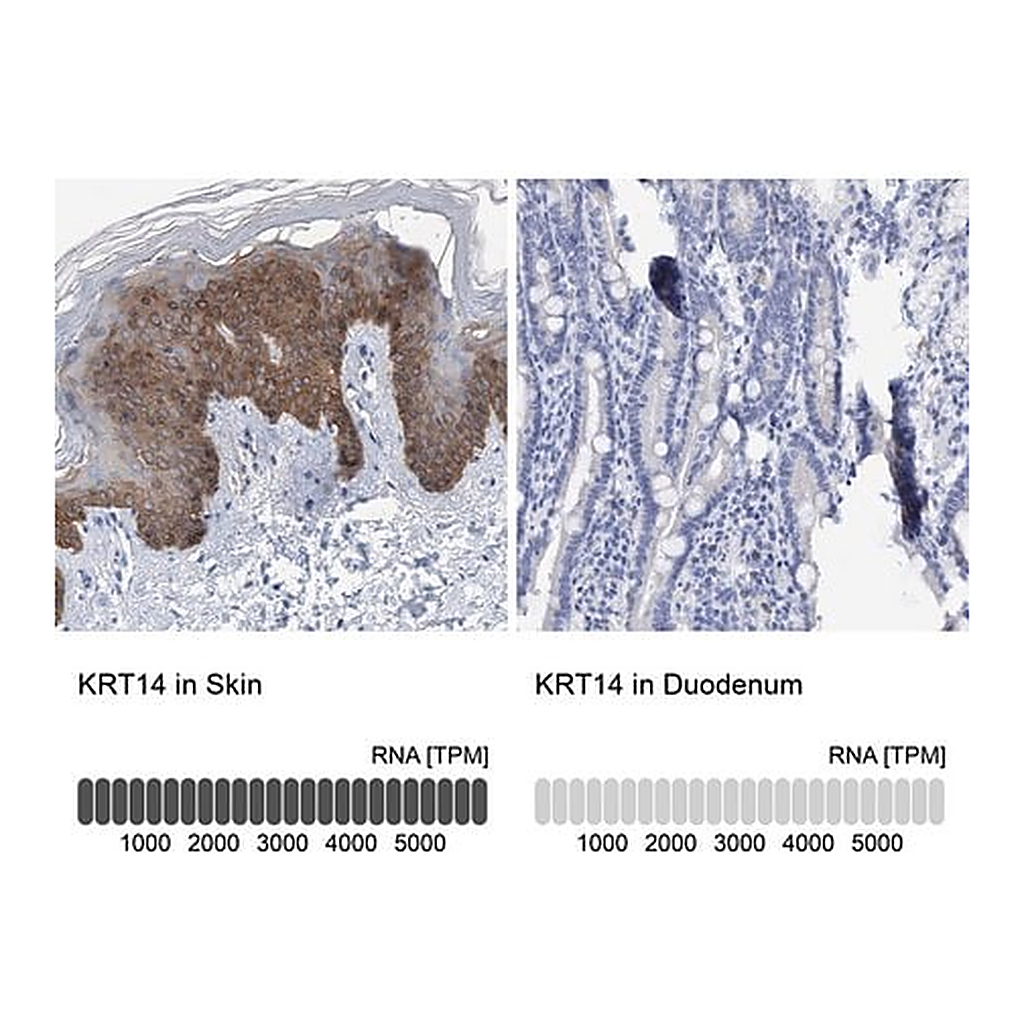 Merck Anti-KRT14 antibody produced in rabbit