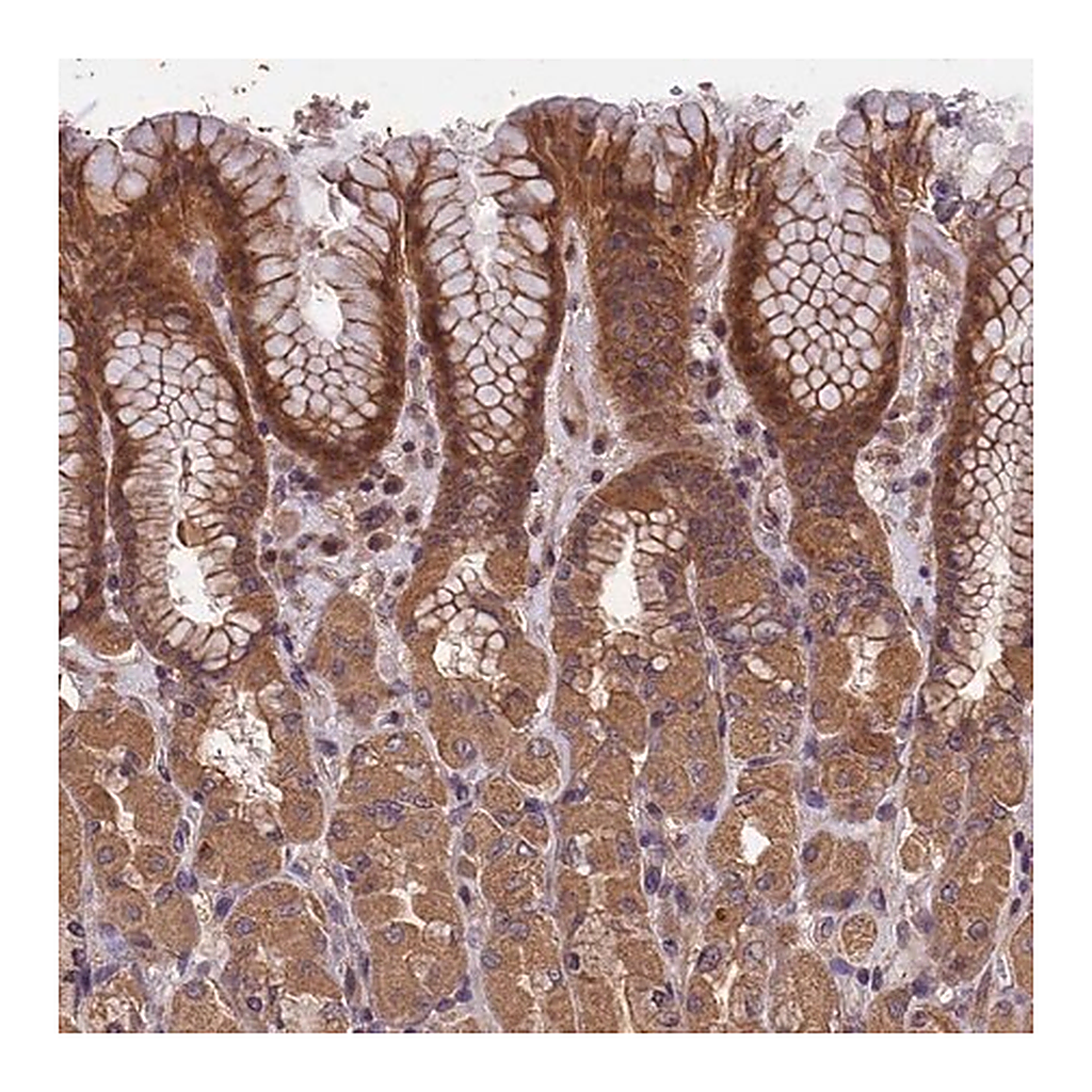 Merck Anti-CHD9 antibody produced in rabbit