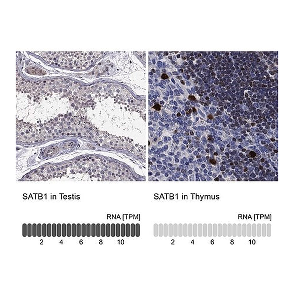 Merck Anti-SATB1 antibody produced in rabbit