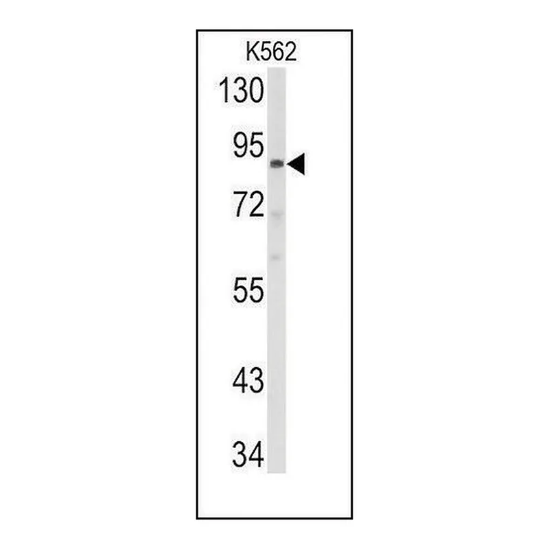 Merck Anti-ABCB5 (N-term) antibody produced in rabbit