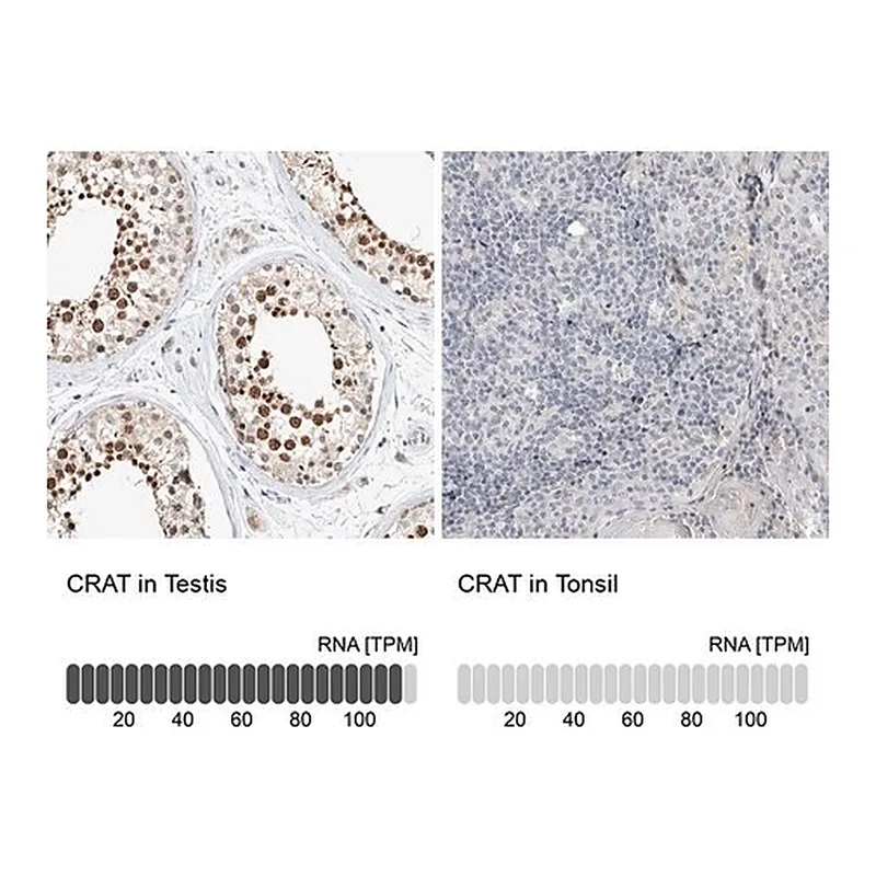 Merck Anti-CRAT antibody produced in rabbit