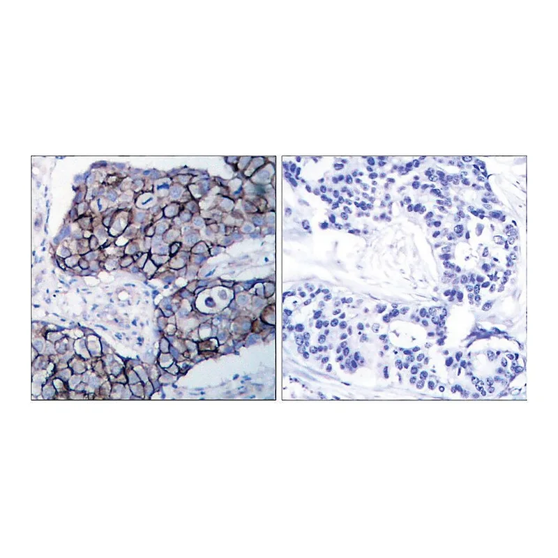 Merck Anti-Integrin beta3 antibody produced in rabbit