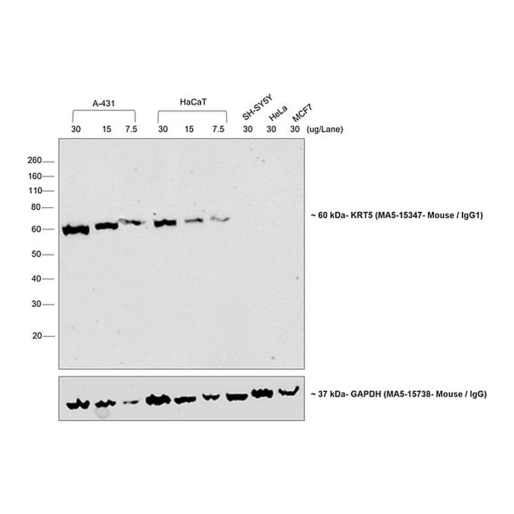 Thermo Fisher Scientific Rat anti-Mouse IgG1 Secondary Antibody, HRP, eBioscience
