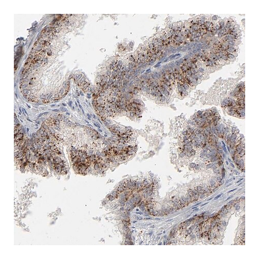 Merck Anti-POMT2 antibody produced in rabbit