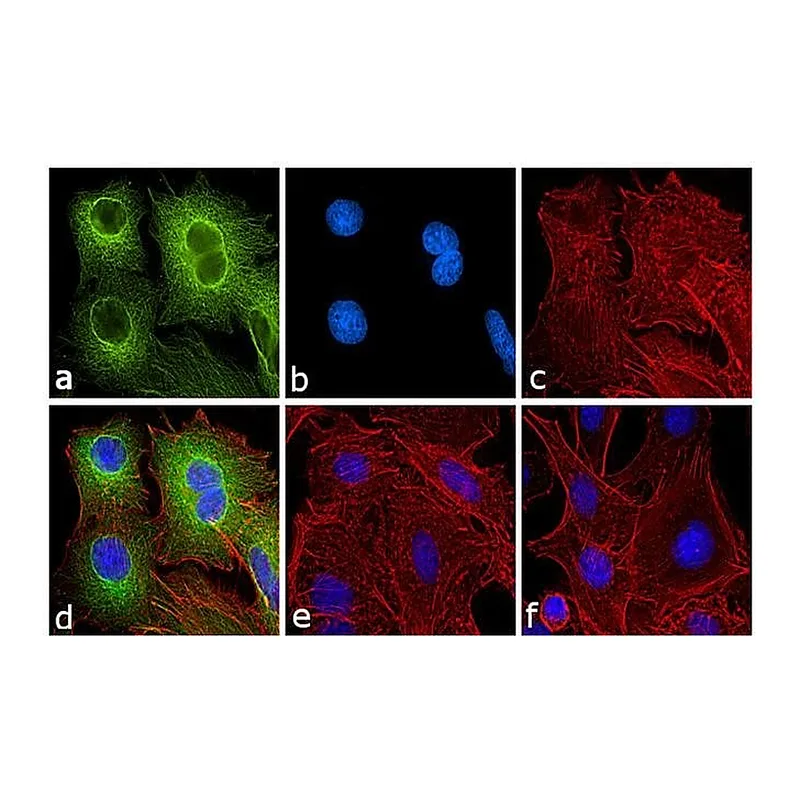 Thermo Fisher Scientific Rabbit anti-Rat IgG (H+L) Secondary Antibody, FITC