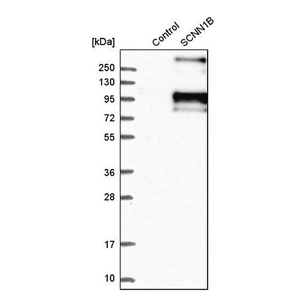 Merck Anti-SCNN1B antibody produced in rabbit