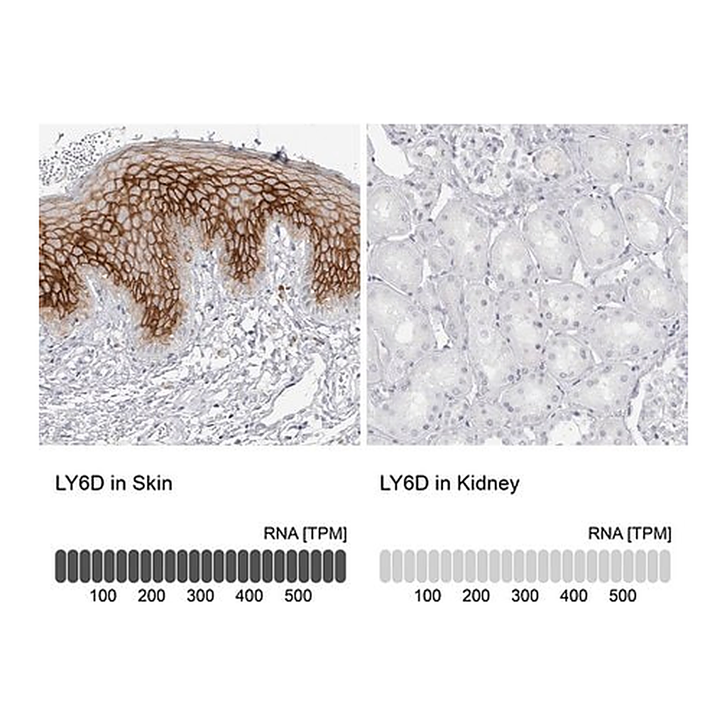 Merck Anti-LY6D antibody produced in rabbit