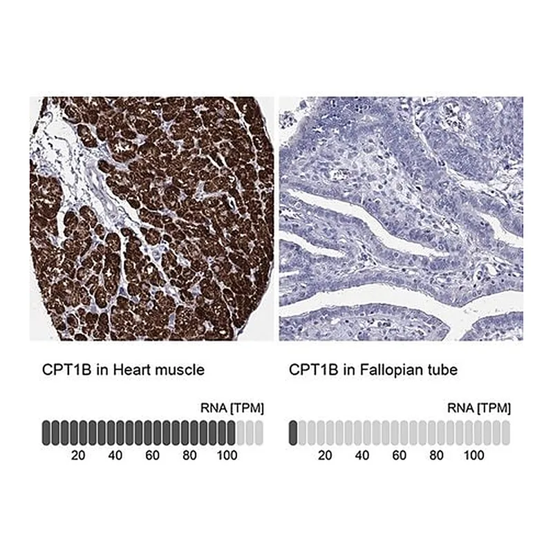 Merck Anti-CPT1B antibody produced in rabbit