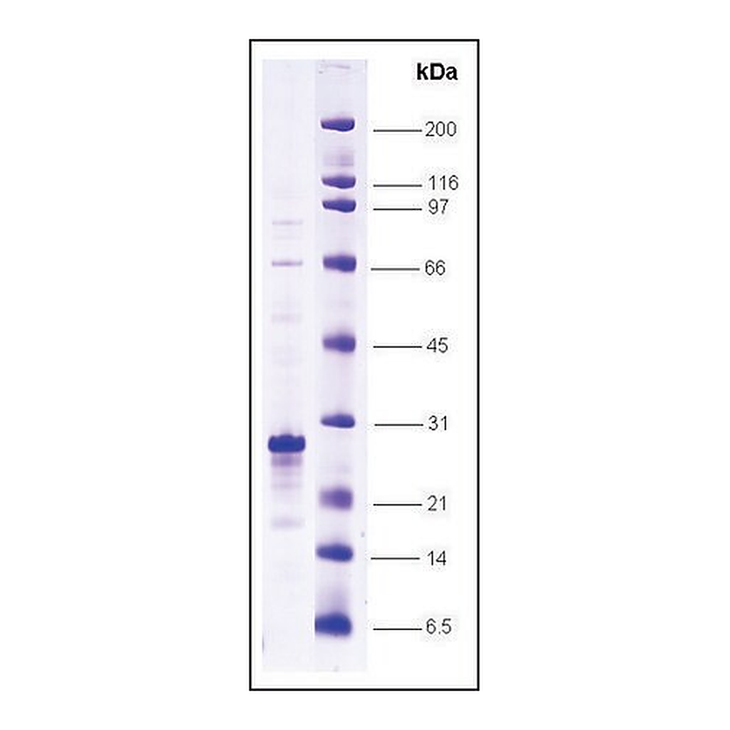 Merck HIF-1 alpha N-terminal activation domain (530-698) human