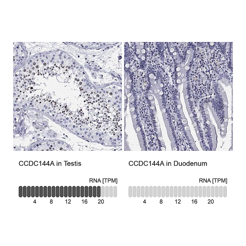 Atlas Antibodies Anti-CCDC144A Antibody