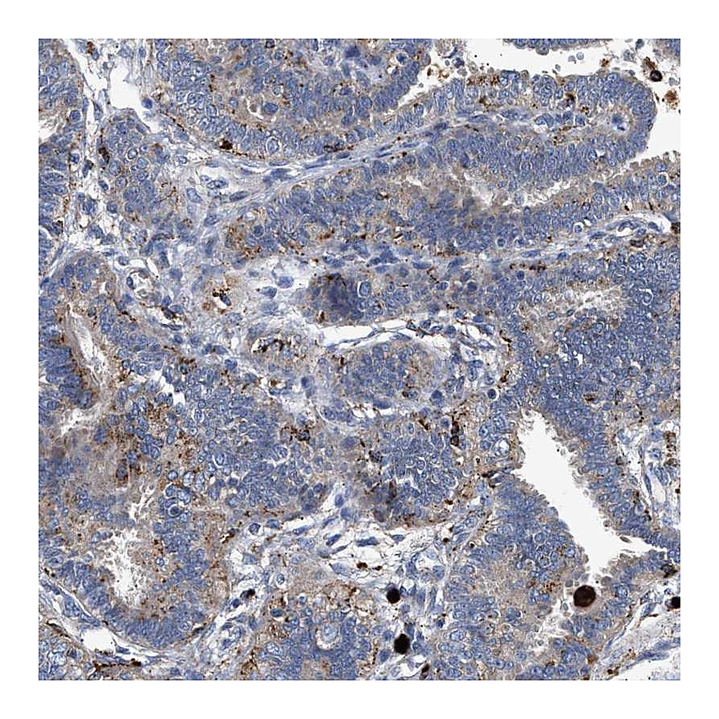 Atlas Antibodies Anti-CCDC146 Antibody