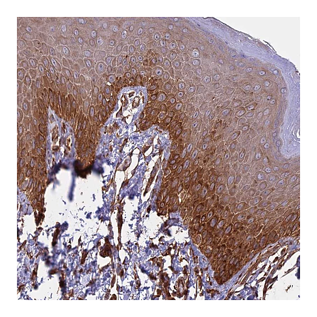 Atlas Antibodies Anti-CCDC148 Antibody