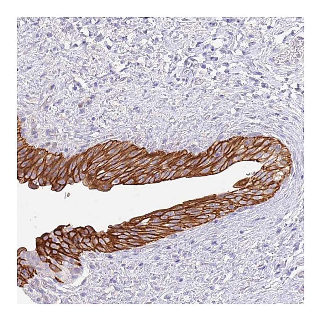 Atlas Antibodies Anti-CCDC149 Antibody