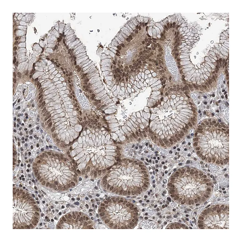 Atlas Antibodies Anti-CCDC152 Antibody