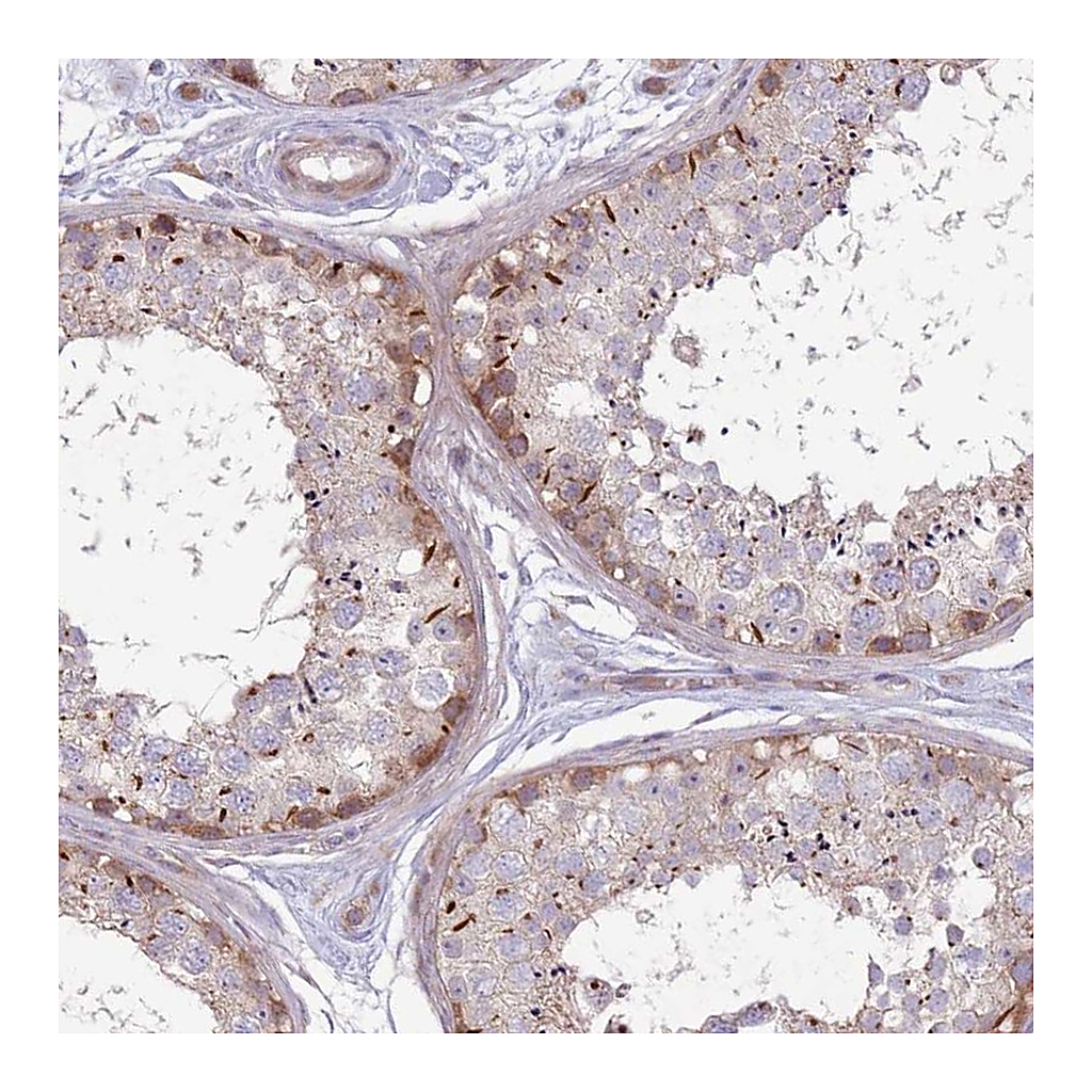 Atlas Antibodies Anti-CCDC150 Antibody