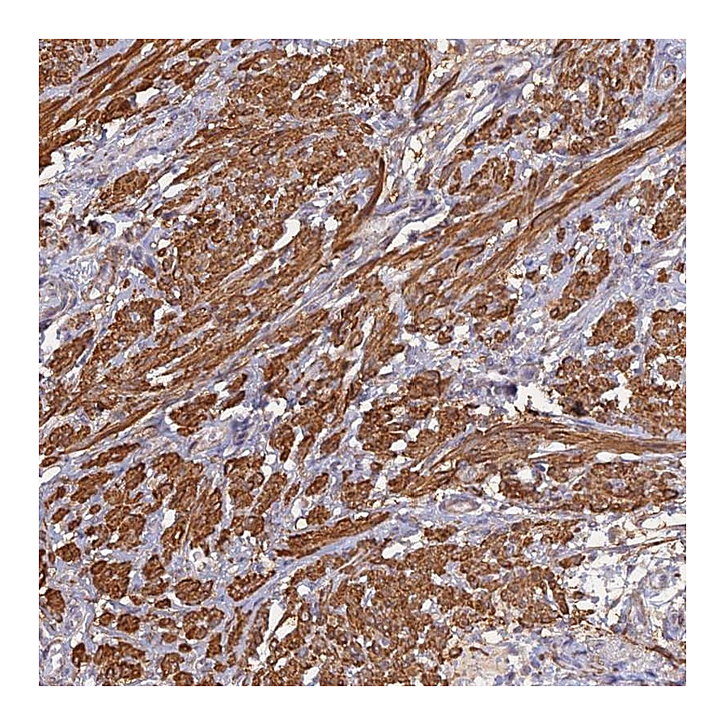 Atlas Antibodies Anti-CCDC154 Antibody