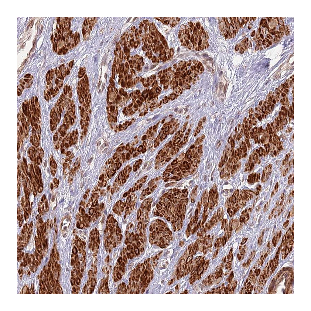 Atlas Antibodies Anti-CCDC154 Antibody