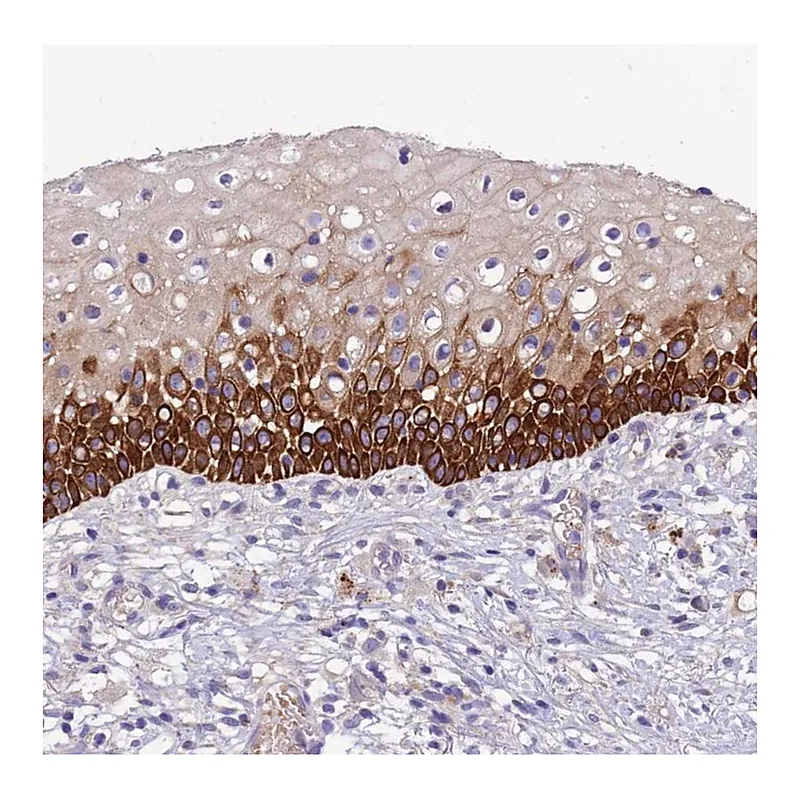 Atlas Antibodies Anti-CCDC157 Antibody