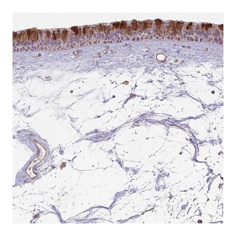 Atlas Antibodies Anti-CCDC168 Antibody