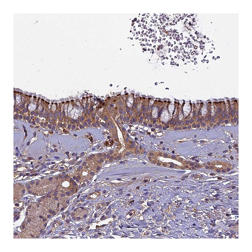 Atlas Antibodies Anti-CCDC167 Antibody