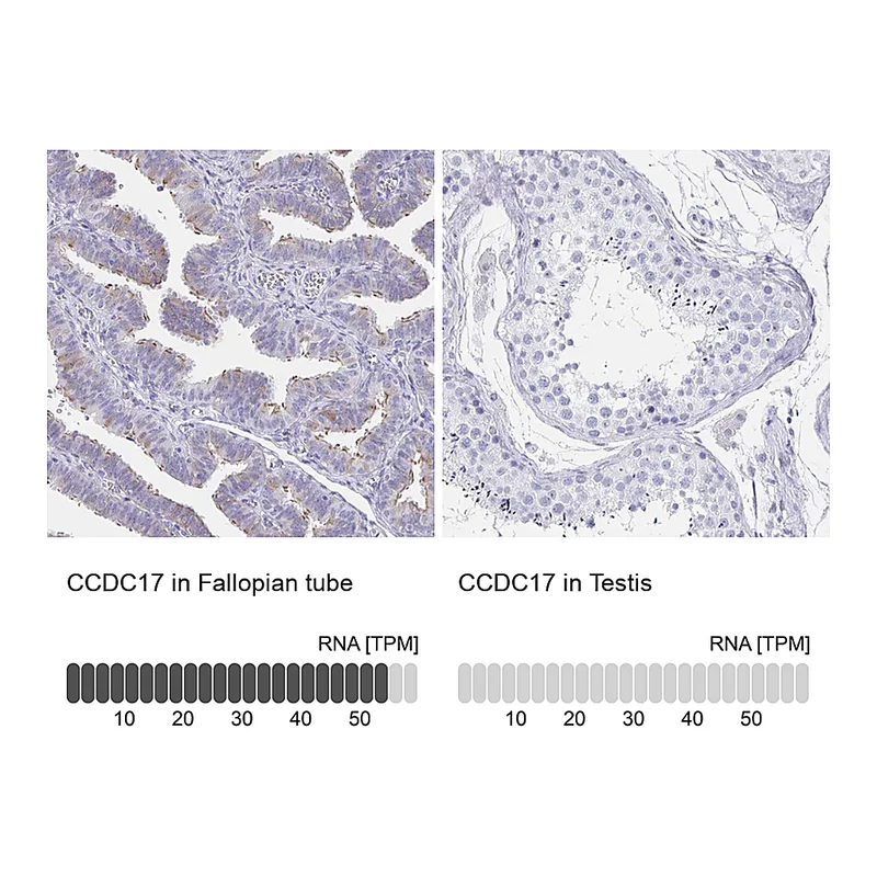Atlas Antibodies Anti-CCDC17 Antibody