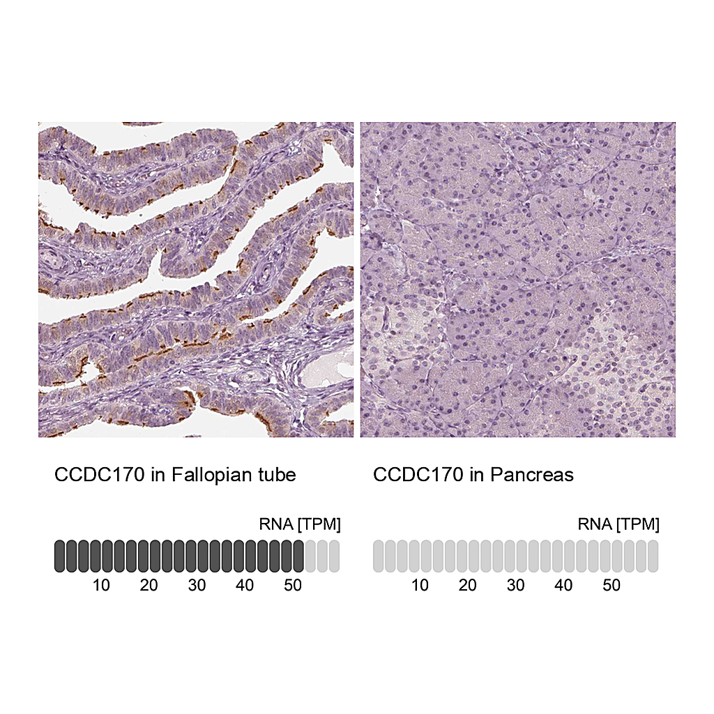 Atlas Antibodies Anti-CCDC170 Antibody