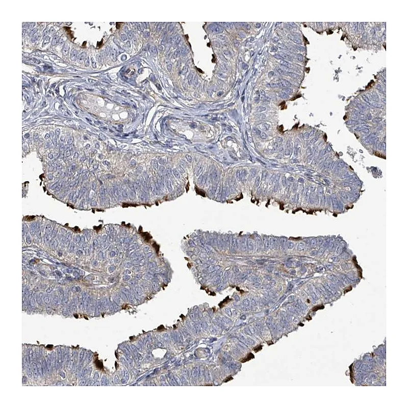 Atlas Antibodies Anti-CCDC173 Antibody