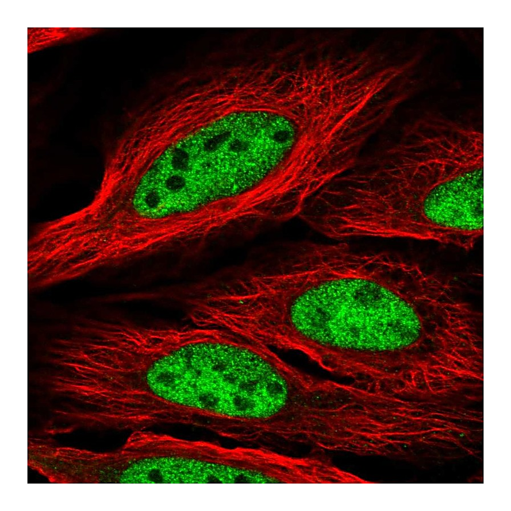 Atlas Antibodies Anti-CCDC174 Antibody