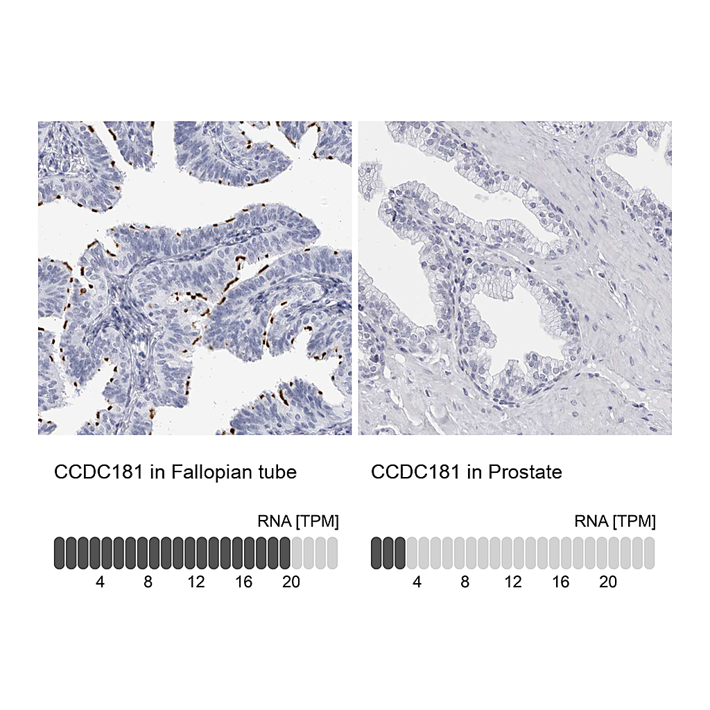 Atlas Antibodies Anti-CCDC181 Antibody