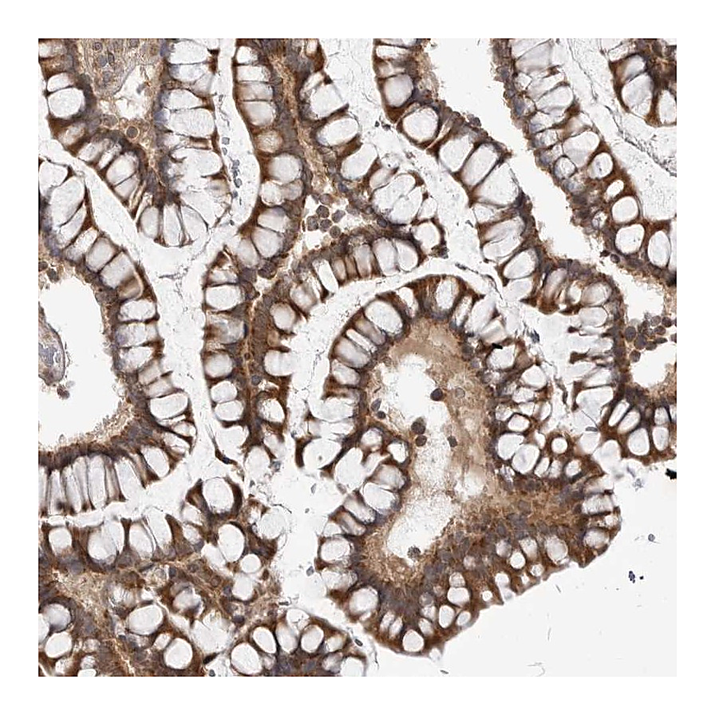 Atlas Antibodies Anti-CCDC18 Antibody