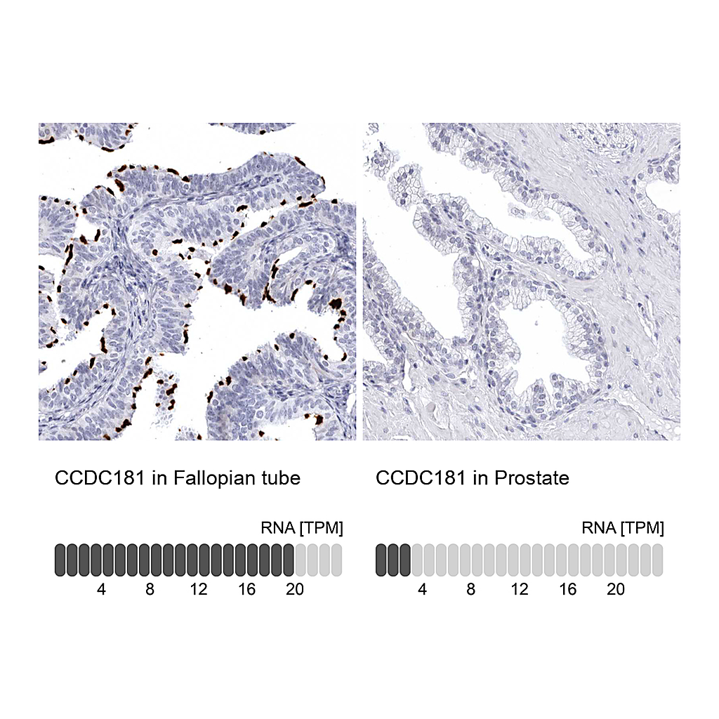 Atlas Antibodies Anti-CCDC181 Antibody